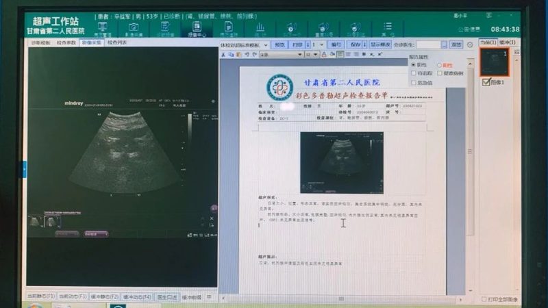 单位体检，一般检查哪些项目？流程详解